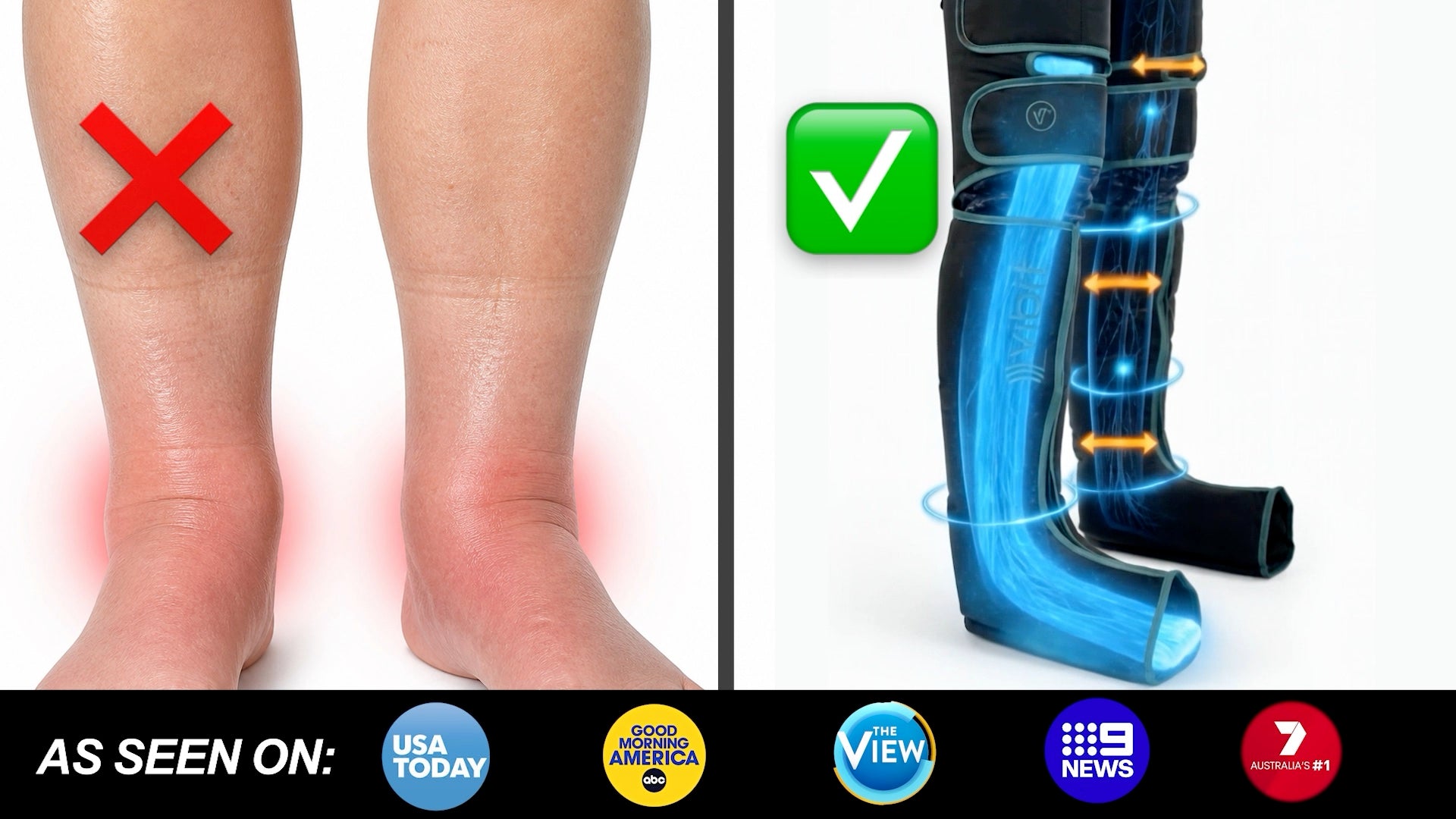 Before and after — heavy swollen legs versus lighter, drained legs after 15 minutes of FlowBoots
